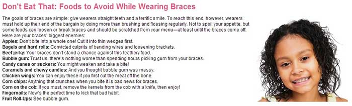 Foods to avoid while wearing braces