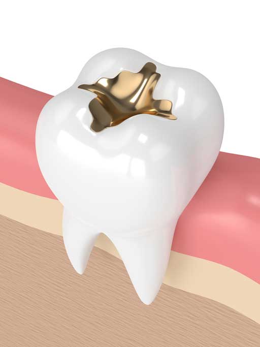 Tooth inside the gums