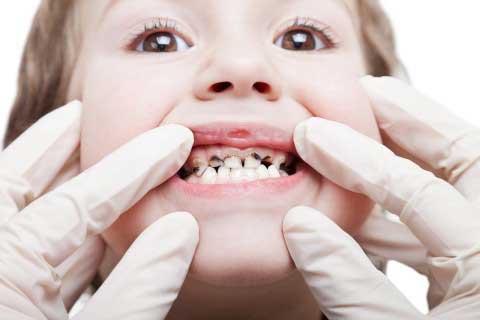 Dentist checking small boy's teeth