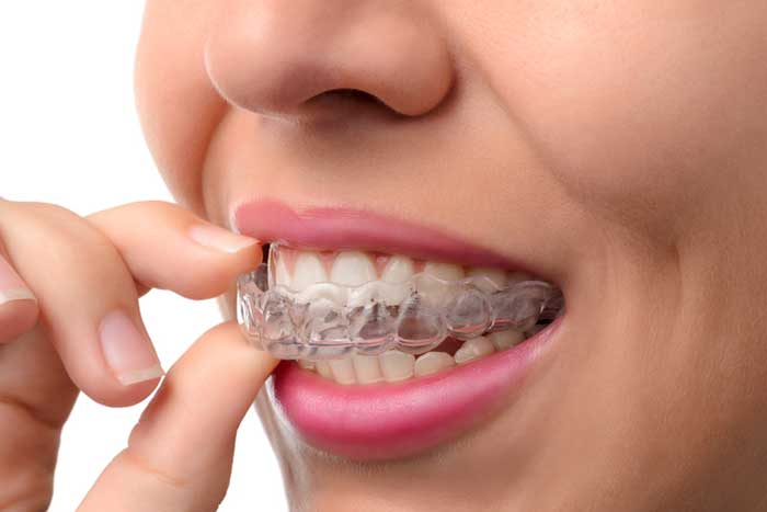 A girl wearing braces